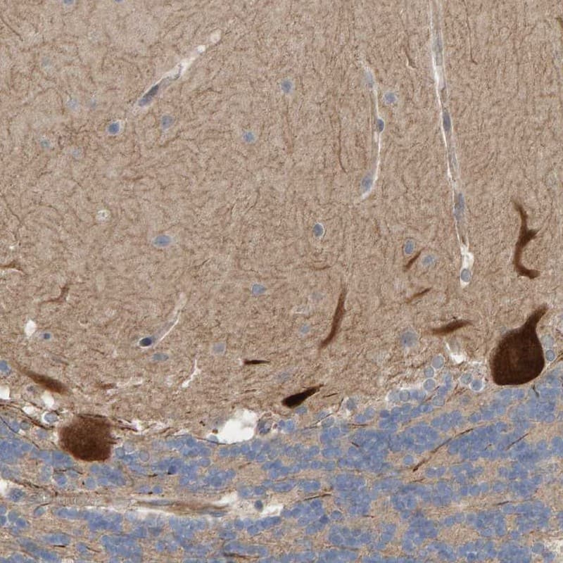 Immunohistochemistry-Paraffin LRSAM1 Antibody - BSA Free