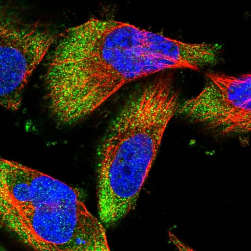 Immunocytochemistry/ Immunofluorescence DCP1B Antibody - BSA Free