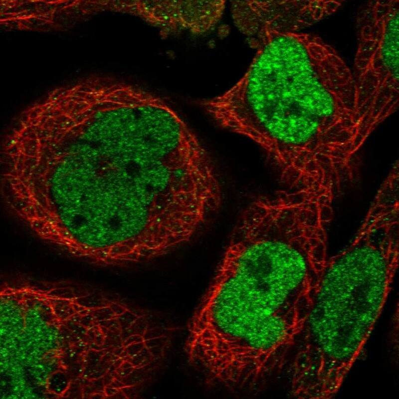 Staining of human cell line A-431 shows localization to nucleoplasm.