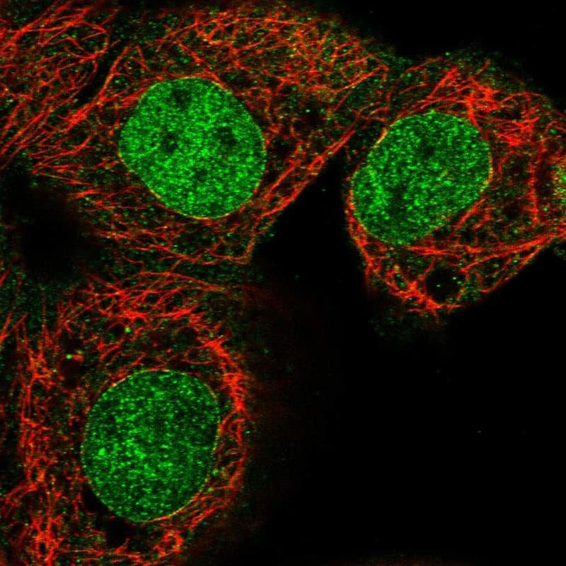 Staining of human cell line A-431 shows localization to nucleoplasm & nuclear membrane.