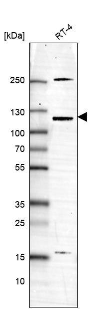 Analysis in human cell line RT-4.