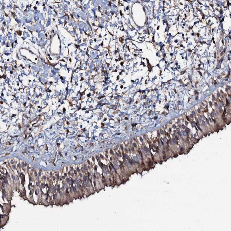 Staining of human nasopharynx shows cytoplasmic positivity.