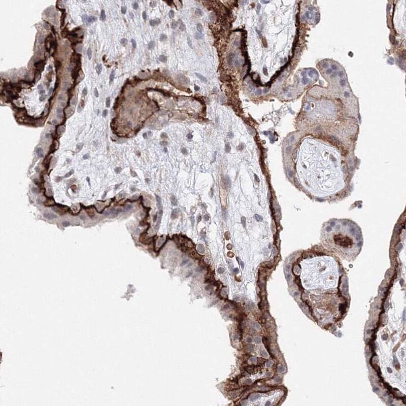 Staining of human placenta shows strong membranous positivity.