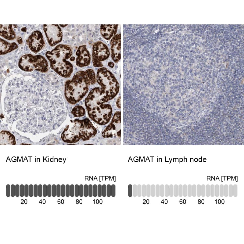 <b>Orthogonal Strategies Validation. </b>Analysis in human kidney and lymph node tissues. Corresponding RNA-seq data are presented for the same tissues.