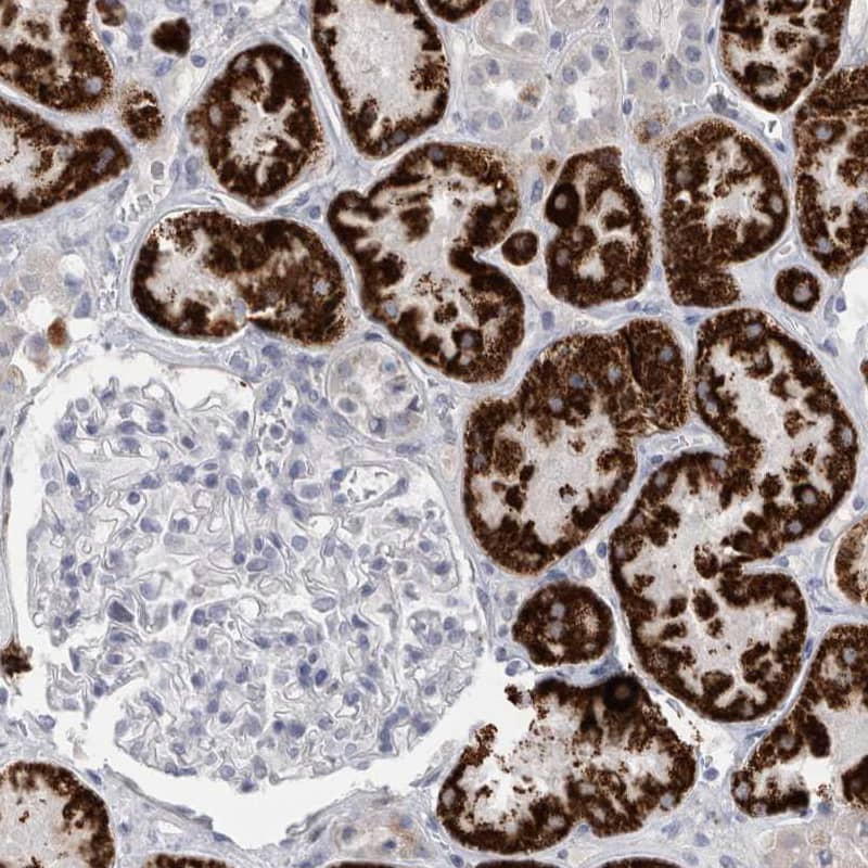 Staining of human kidney shows strong granular cytoplasmic positivity in cells in tubules.