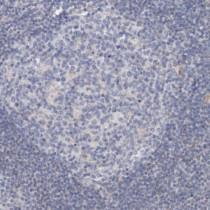Staining of human lymph node shows very weak cytoplasmic positivity in lymphoid cells.
