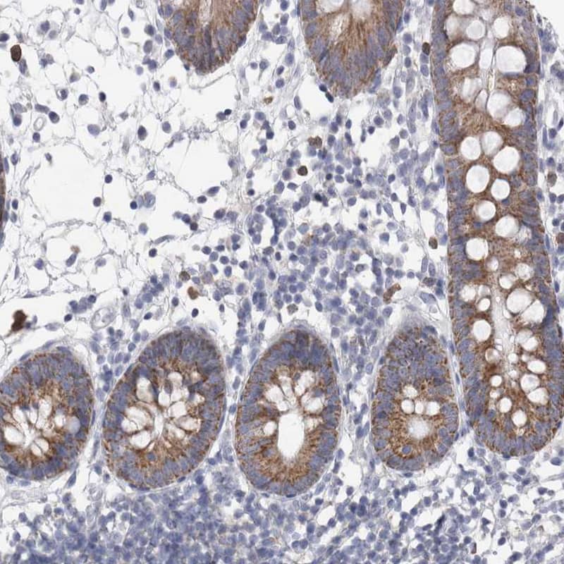Staining of human colon shows moderate granular cytoplasmic positivity in glandular cells.