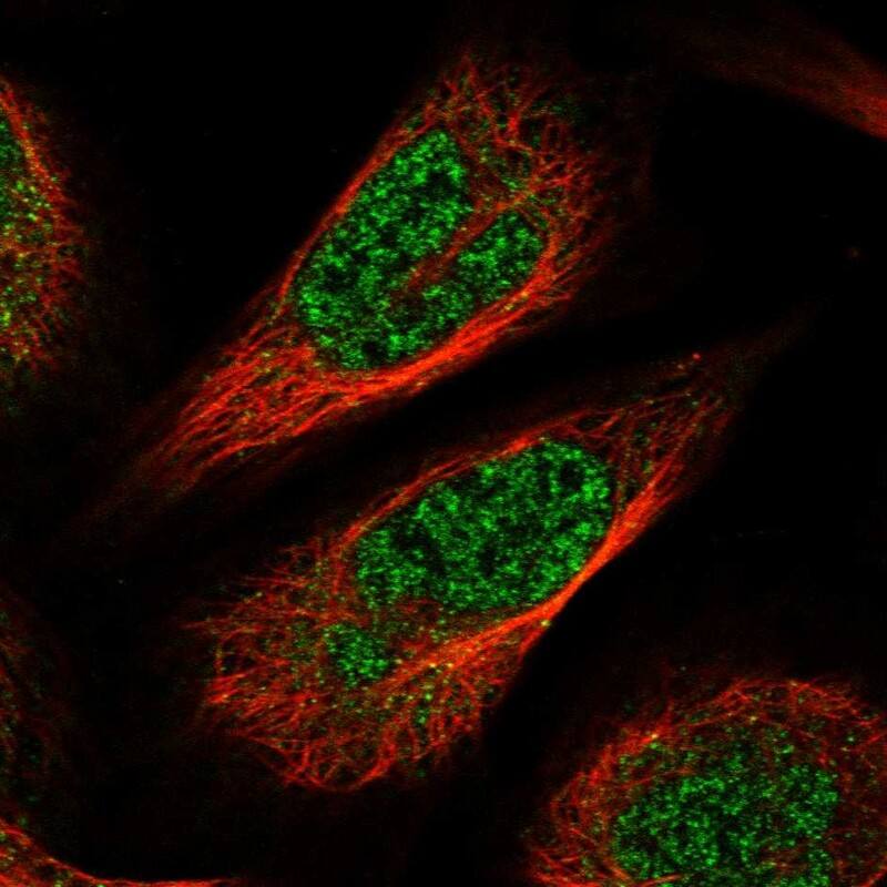 Immunocytochemistry/ Immunofluorescence CCDC126 Antibody - BSA Free
