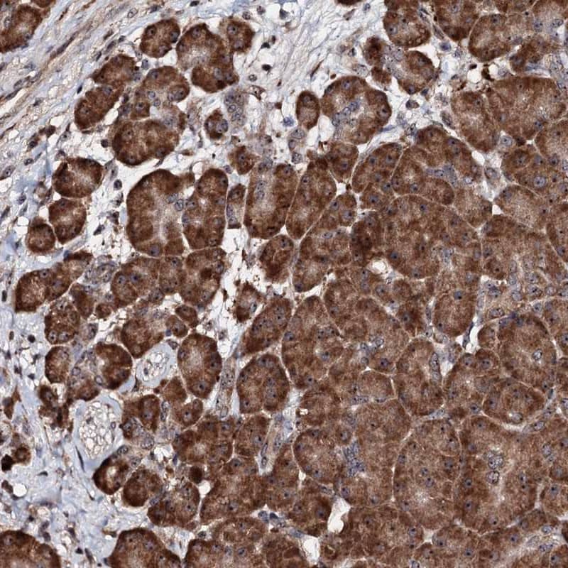 Immunohistochemistry-Paraffin FAM111A Antibody - BSA Free