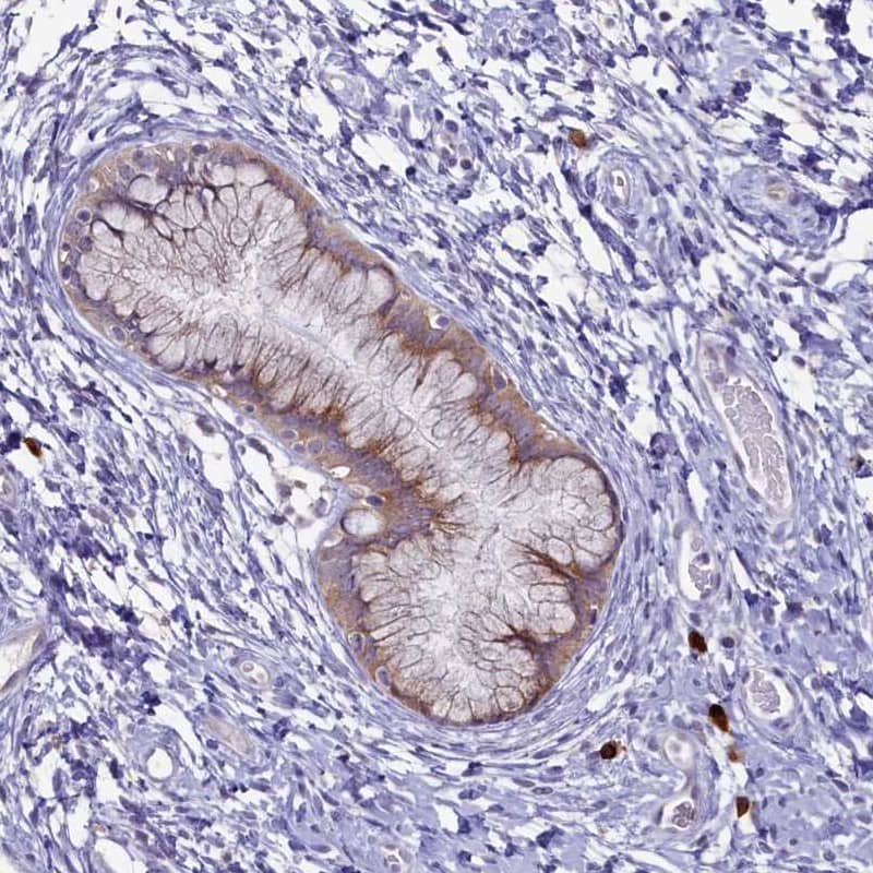 Immunohistochemistry-Paraffin METTL25 Antibody - BSA Free