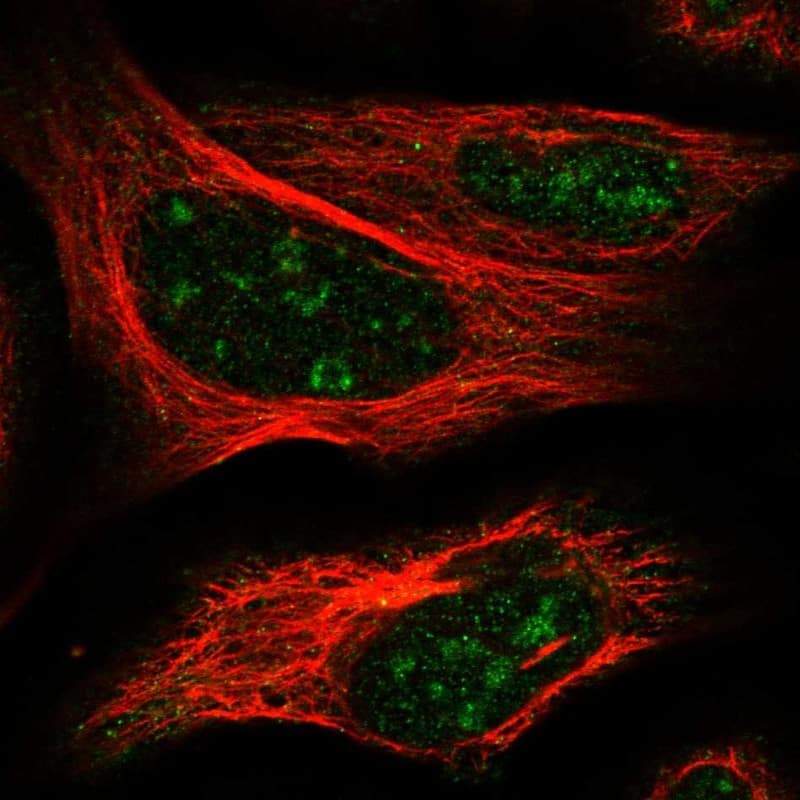 Staining of human cell line U-2 OS shows localization to nucleoli.