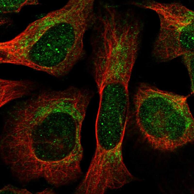 Immunocytochemistry/ Immunofluorescence THNSL1 Antibody - BSA Free