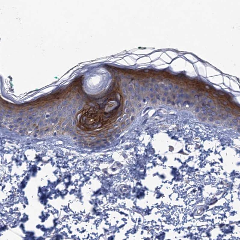 Staining of human skin shows moderate to strong cytoplasmic and membranous positivity in squamous epithelial cells.