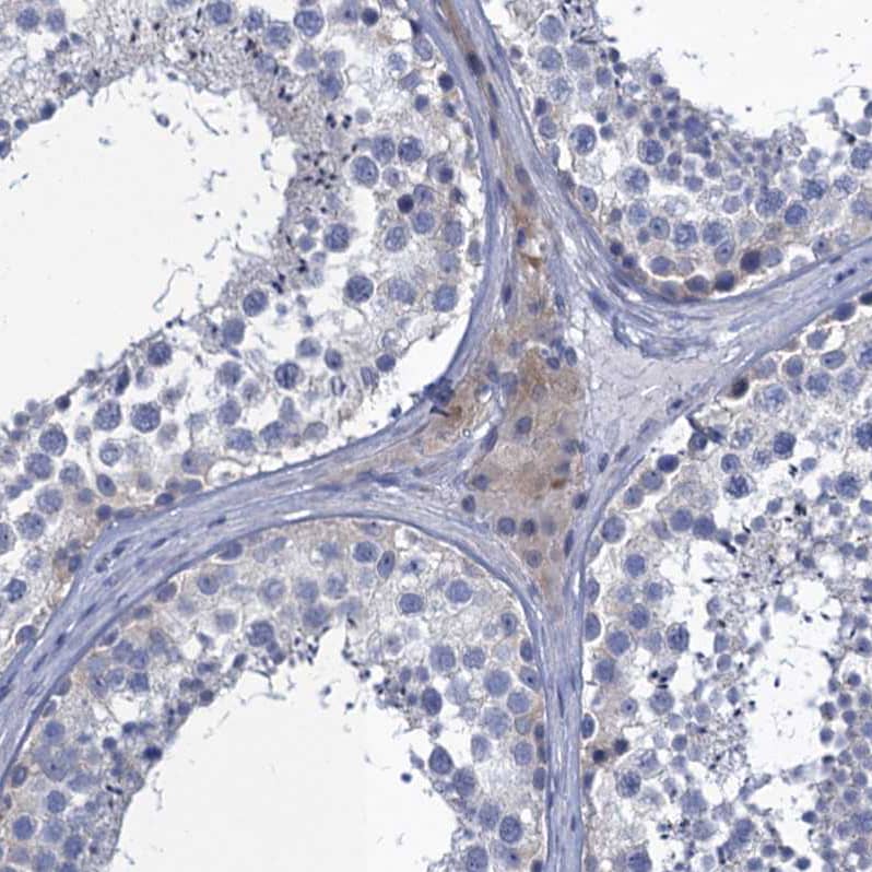 Staining of human testis shows weak cytoplasmic positivity in Leydig cells.
