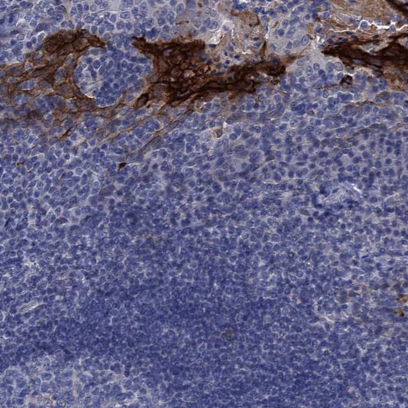 Staining of human tonsil shows strong cytoplasmic  and membranous positivity in squamous epithelial cells.