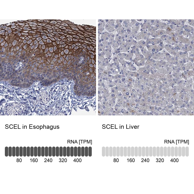 <b>Orthogonal Strategies Validation. </b>Analysis in human esophagus and liver tissues. Corresponding RNA-seq data are presented for the same tissues.