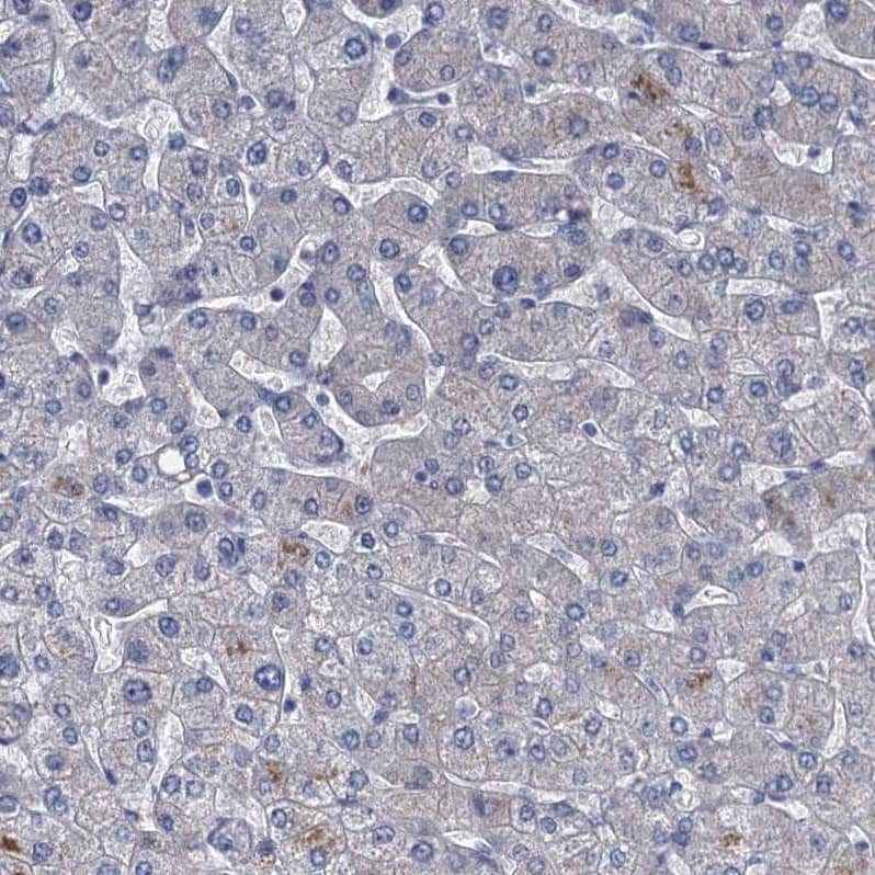 Staining of human liver shows no positivity in hepatocytes as expected.