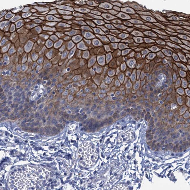 Staining of human esophagus shows strong membranous positivity in squamous epithelial cells.