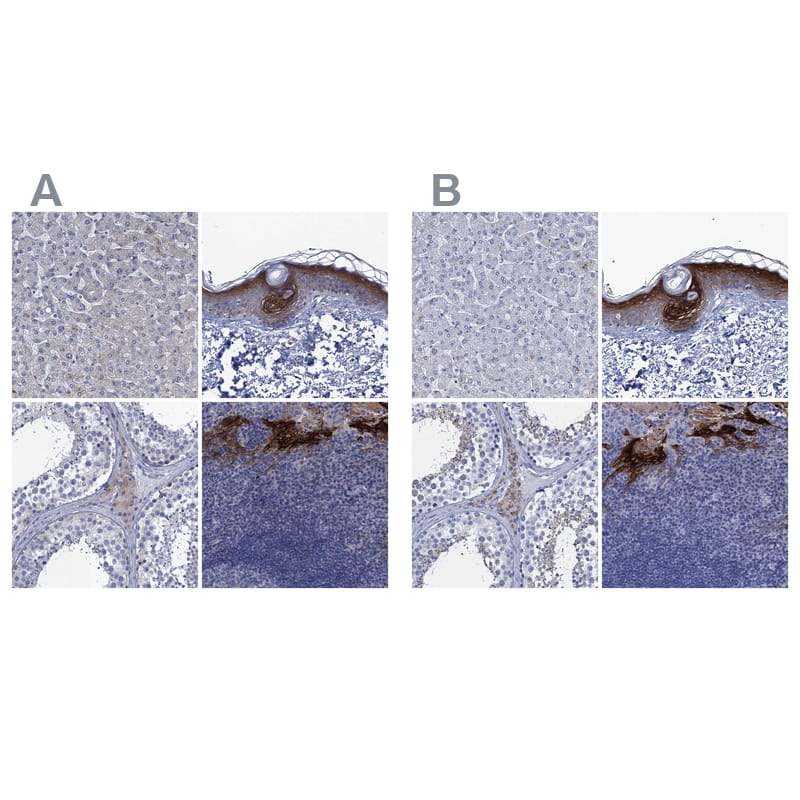 <b>Orthogonal Strategies Validation. </b>Staining of human liver, skin, testis and tonsil HPA039737 (A) shows similar protein distribution across tissues to independent antibody HPA040154 (B).