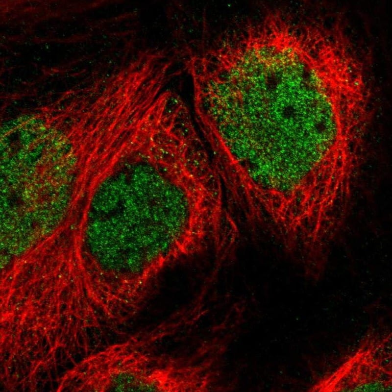 <b>Independent Antibodies Validation. </b>Staining of human cell line A-431 shows localization to nucleoplasm.