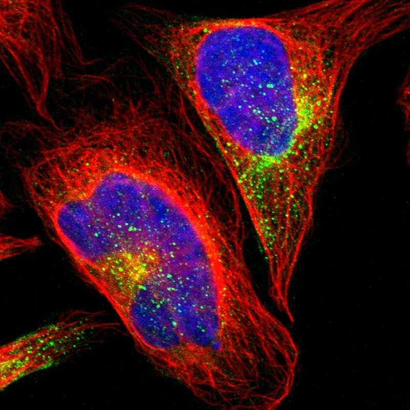 Staining of human cell line U-2 OS shows localization to cytosol.
