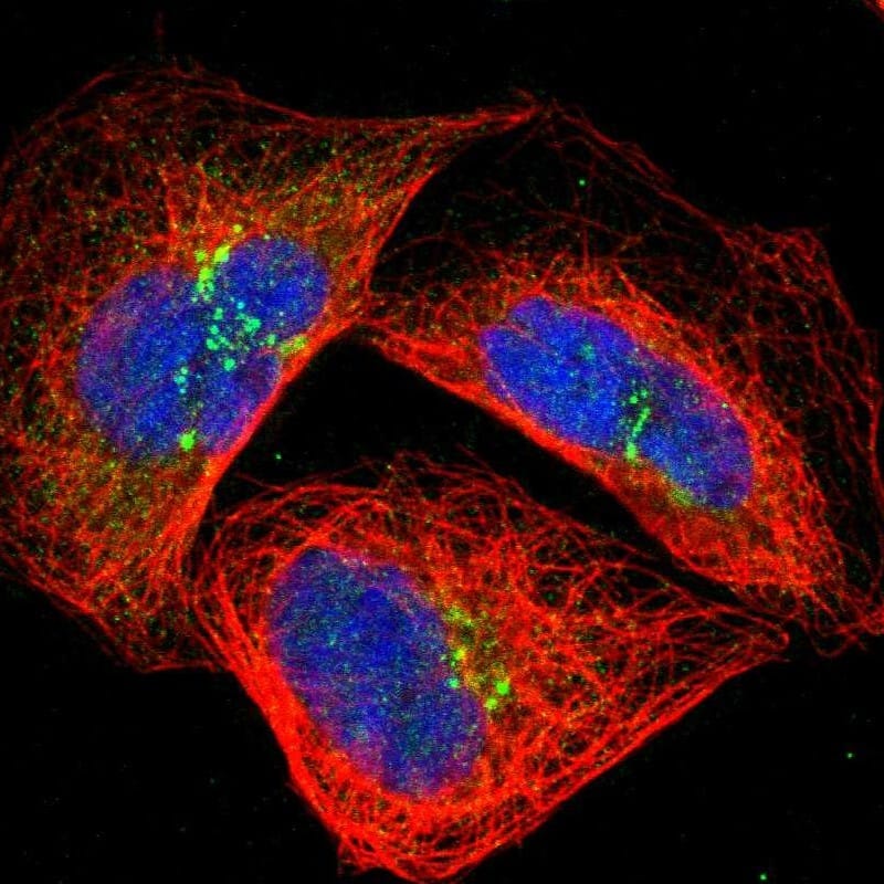 Staining of human cell line A-431 shows localization to nucleoplasm, cytosol & the Golgi apparatus.
