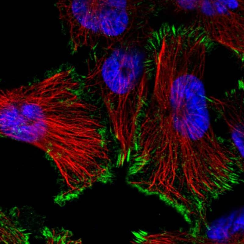 Staining of human cell line U-251 MG shows localization to focal adhesion sites.