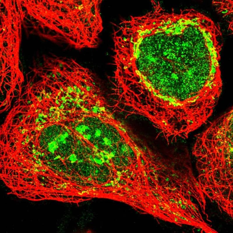 Staining of human cell line A-431 shows positivity in nucleus, nucleoli & mitochondria.
