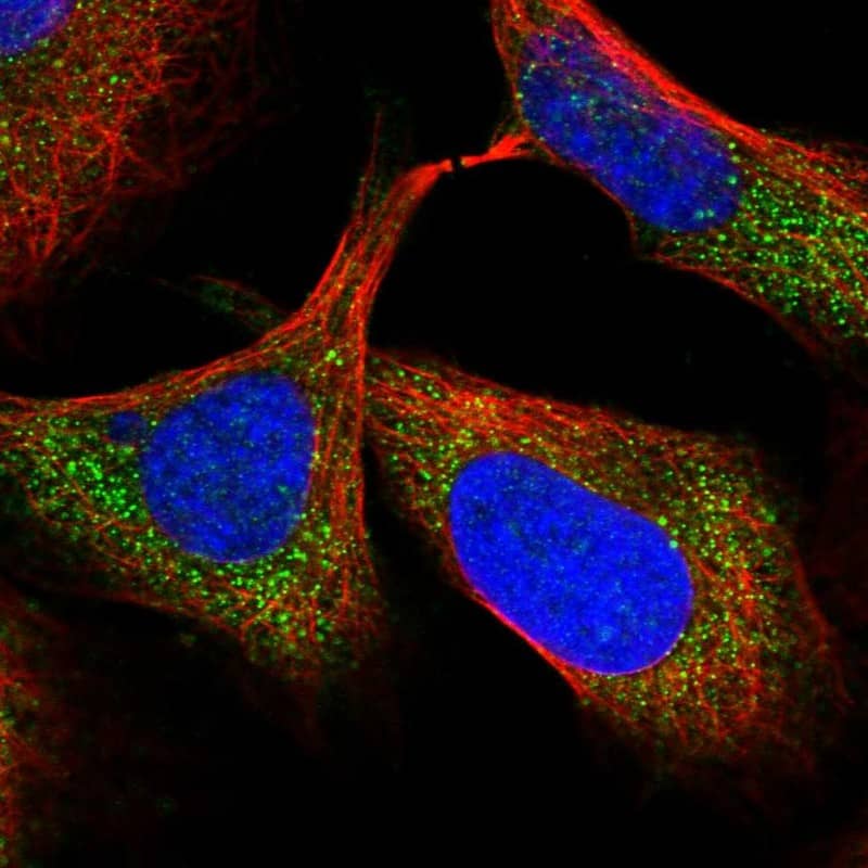 Immunocytochemistry/ Immunofluorescence TTC38 Antibody - BSA Free