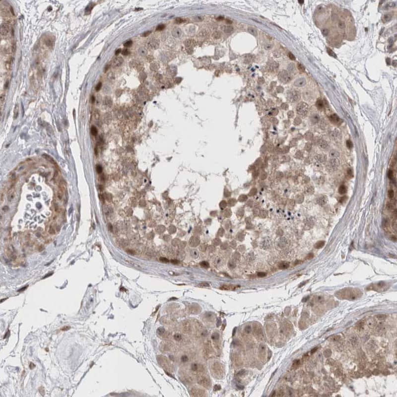 Immunohistochemistry-Paraffin Exosome component 4 Antibody - BSA Free