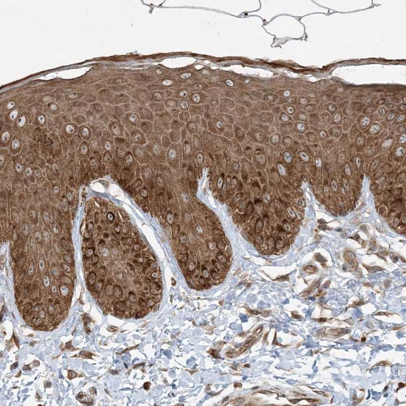 Staining of human skin shows strong cytoplasmic positivity in squamous epithelial cells.