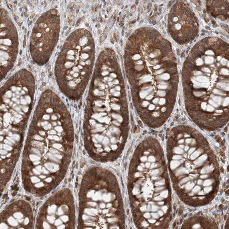 Staining of human rectum shows strong cytoplasmic positivity in glandular cells.