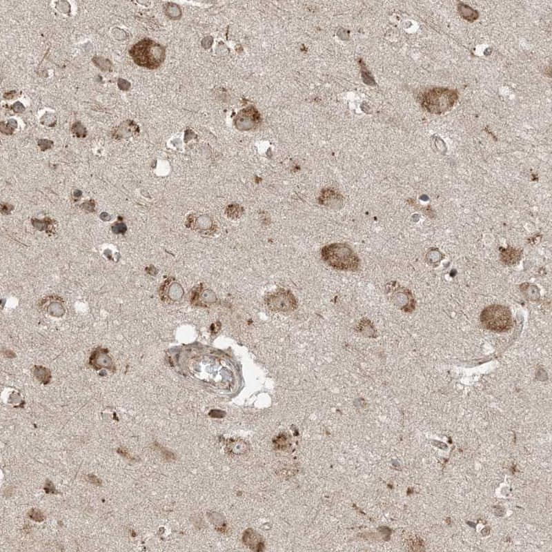 Staining of human cerebral cortex shows moderate cytoplasmic positivity in neurons.