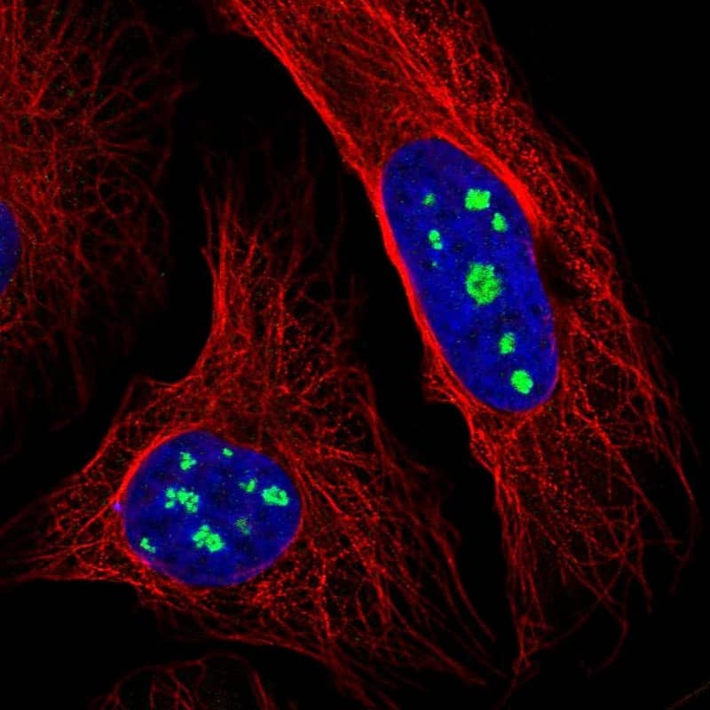 Staining of human cell line U-2 OS shows localization to nucleoli.