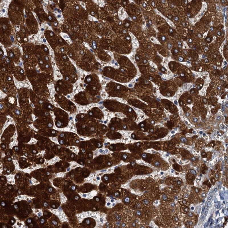 Staining of human liver shows strong cytoplasmic positivity in hepatocytes.