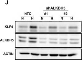 Western Blot: ALKBH5 Antibody [NBP1-82188] - ZNF217 & ALKBH5 regulate NANOG & KLF4 expression via modulation of m6A levels. J. MCF-7 subclones exposed to 20% or 1% O2 for 48 h & immunoblot assays performed. Image collected & cropped by CiteAb from the following publication (//www.oncotarget.com/lookup/doi/10.18632/oncotarget.11743), licensed under a CC-BY license. Not internally tested by Novus Biologicals.