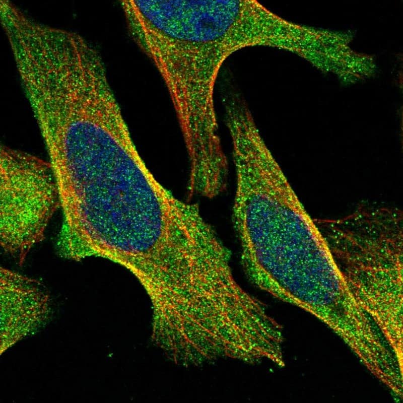 Staining of human cell line U-2 OS shows localization to cytosol.