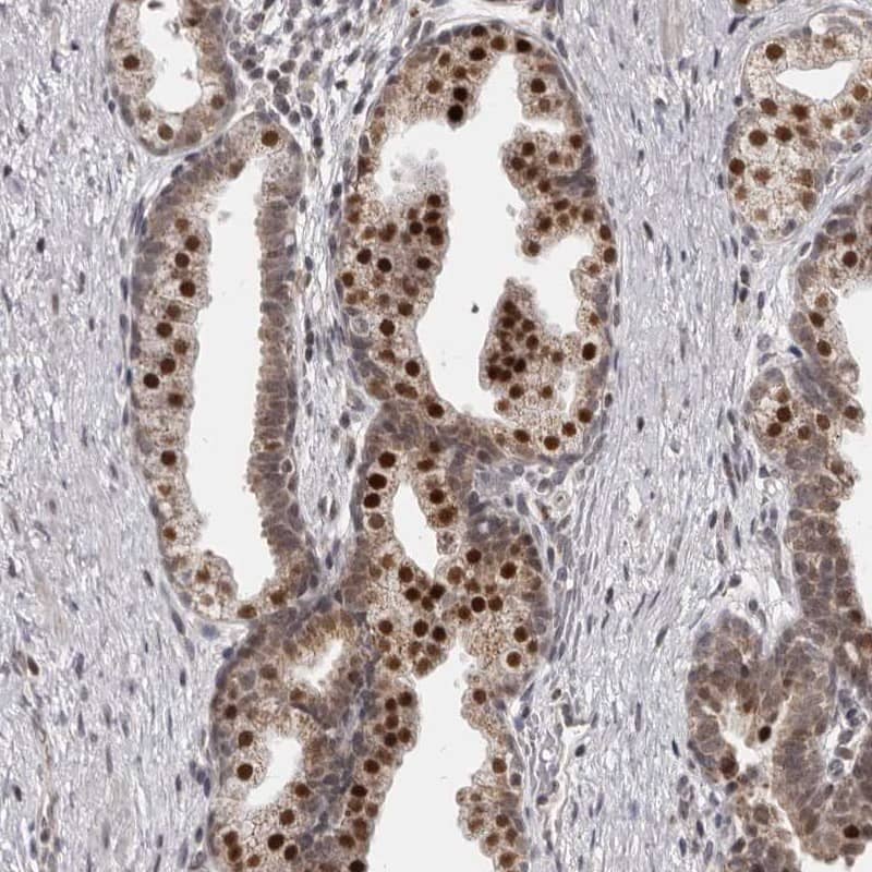 Immunohistochemistry-Paraffin THUMPD1 Antibody - BSA Free