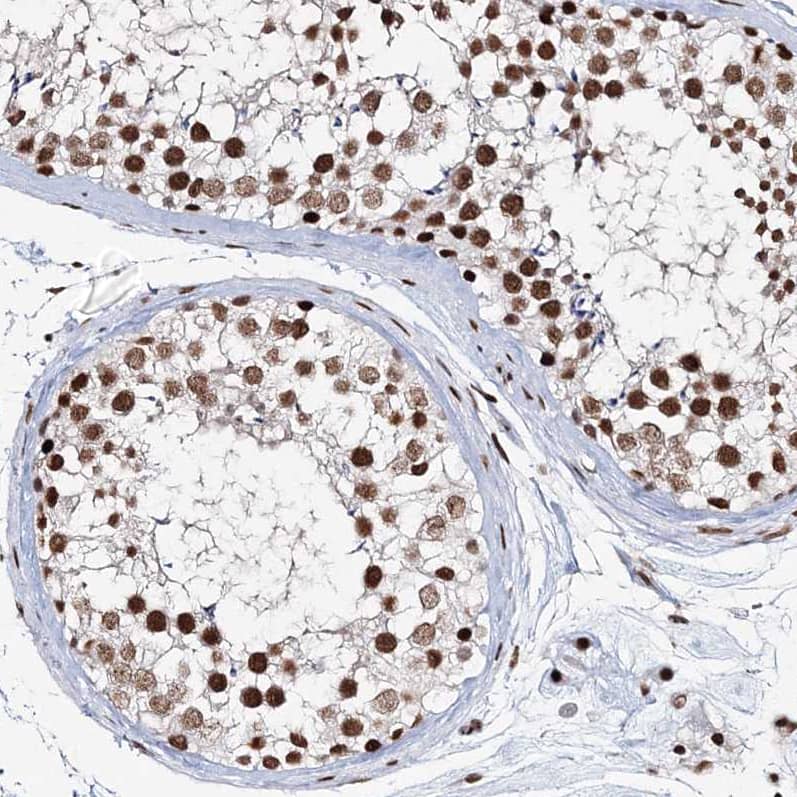 Staining of human testis shows moderate to strong nuclear positivity in cells in seminiferous ducts.