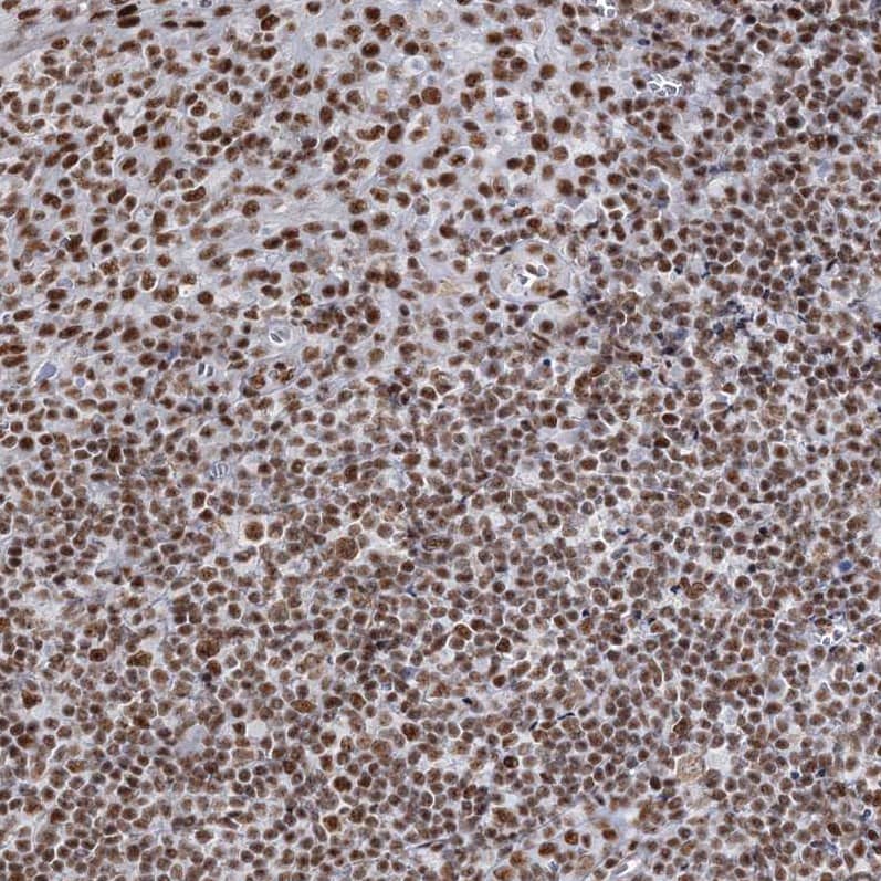 Staining of human tonsil shows strong nuclear positivity in non-germinal center cells.