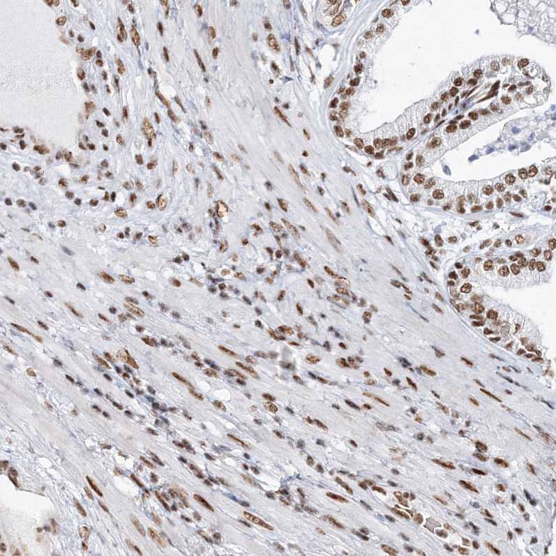 Staining of human prostate shows moderate nuclear positivity in smooth muscle cells and glandular cells.