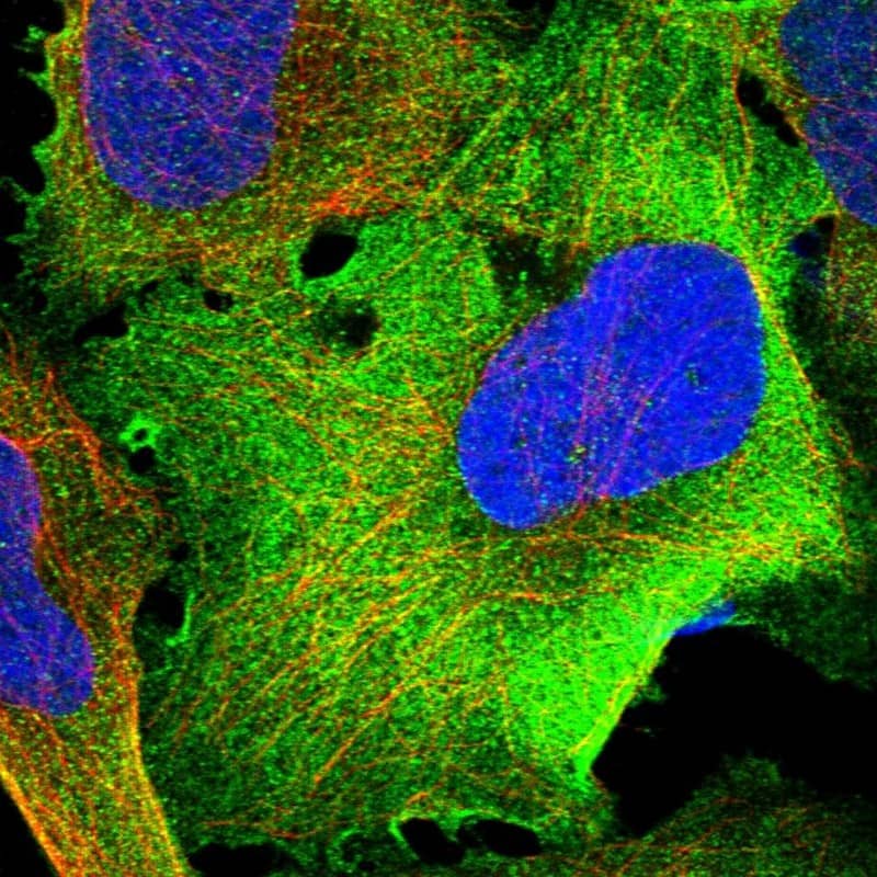 Staining of human cell line U-2 OS shows positivity in plasma membrane & cytoplasm.