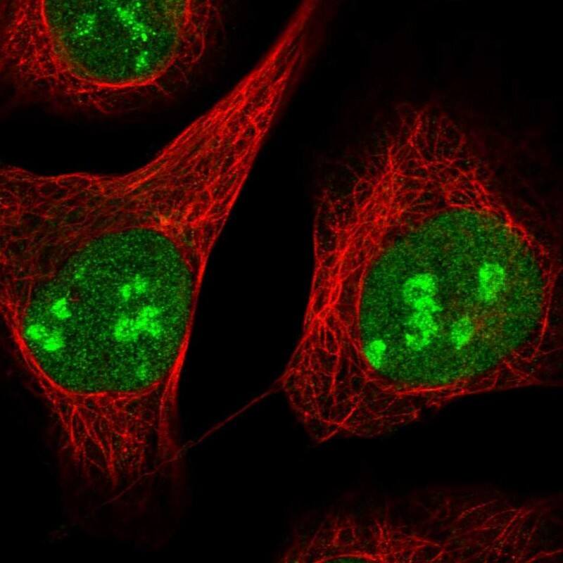 Staining of human cell line U-2 OS shows localization to nucleus & nucleoli.