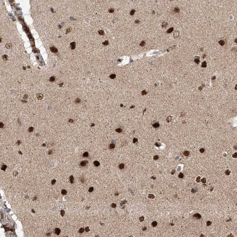 Immunohistochemistry-Paraffin ZNF280D Antibody - BSA Free