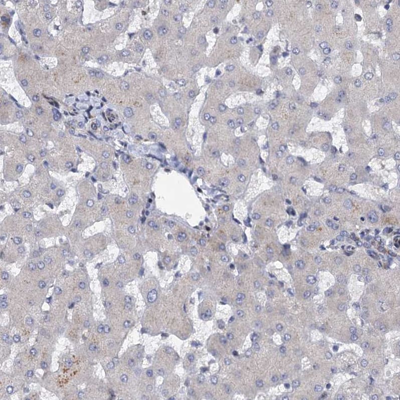 Immunohistochemistry-Paraffin QPCTL Antibody - BSA Free