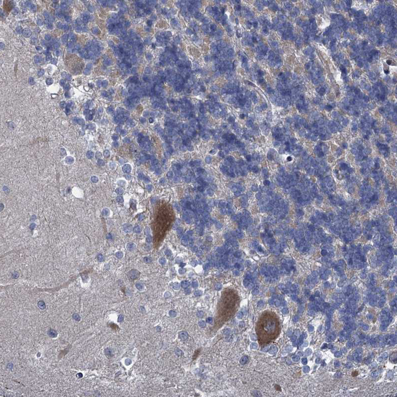 Staining of human Cerebellum shows moderate cytoplasmic positivity in Purkinje cells.