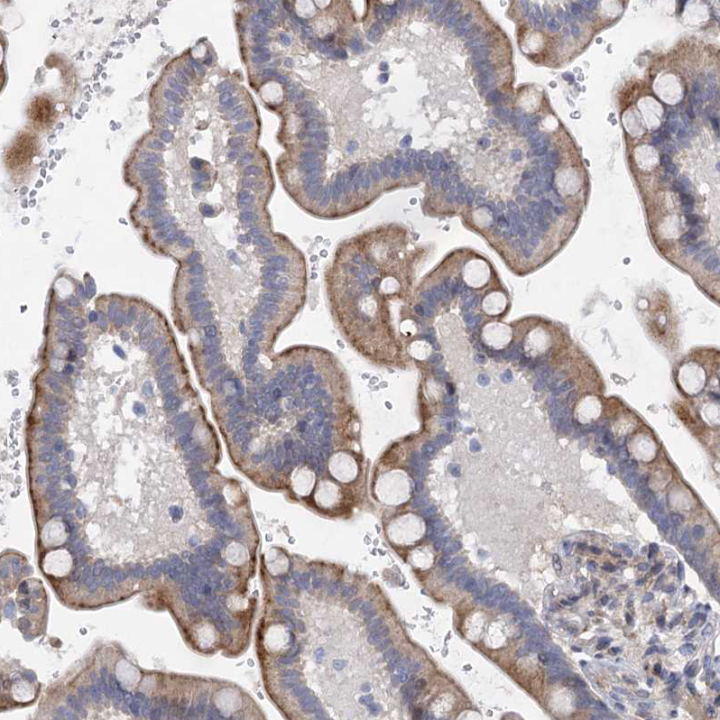 Staining of human Colon shows moderate cytoplasmic positivity in glandular cells.