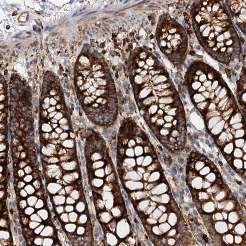 Staining of human colon shows strong cytoplasmic positivity in glandular cells.