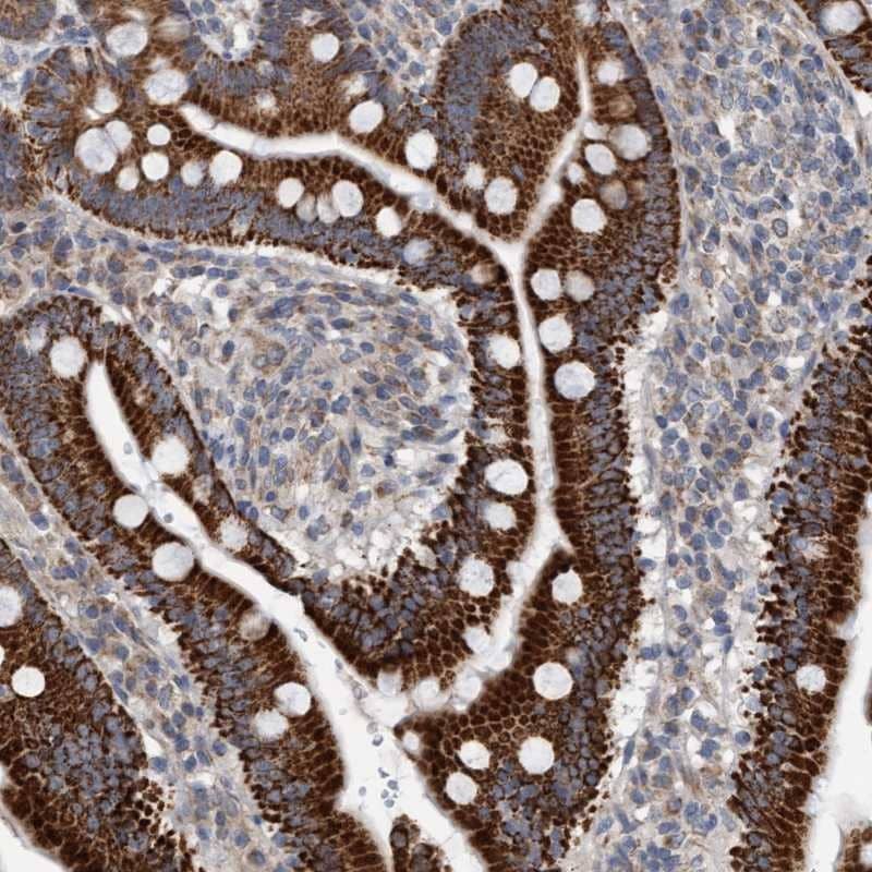 Immunohistochemistry-Paraffin ZNF566 Antibody - BSA Free