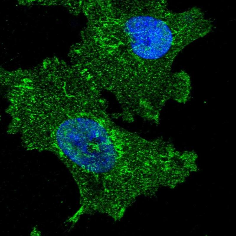 Staining of human cell line U-251 MG shows localization to nucleoplasm, plasma membrane, mitochondria & focal adhesion sites.